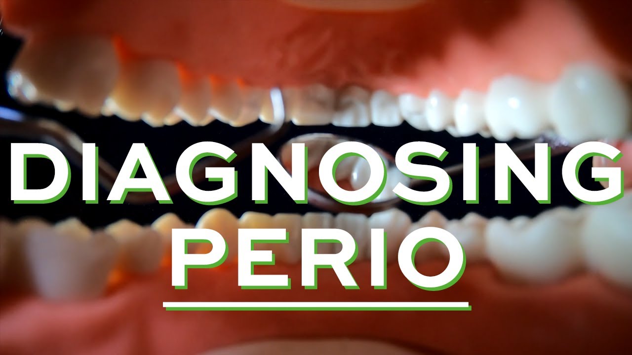 The Only Way To Diagnose Gum Disease - New BSP classification made easy