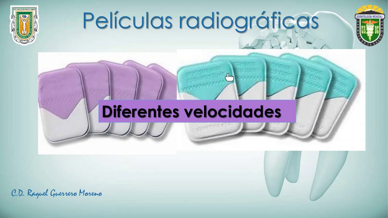 INTRODUCCIÓN A LA RADIOLOGÍA BUCAL