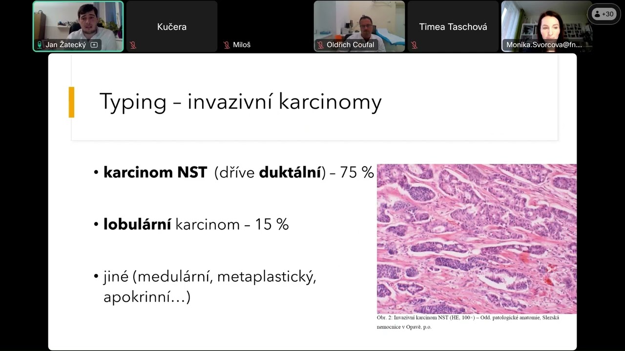 WINS webin&aacute;ř 06 N&aacute;dory prsu 24 4 2024
