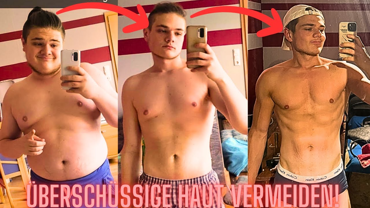 &Uuml;bersch&uuml;ssige Haut durch Abnehmen | Meine Erfahrungen und Tipps