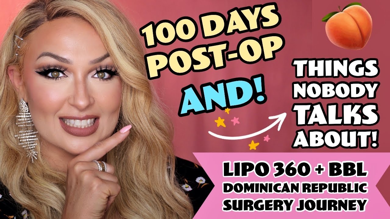 100 Days Post-Op Lipo 360 + BBL 🍑 Things Nobody Talks About //  Dominican Republic - Dr Medina