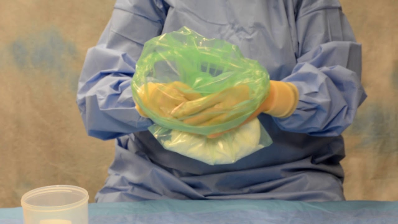 cranial bone flap storage