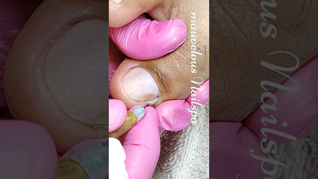 Full video pedicure and dryskin removal