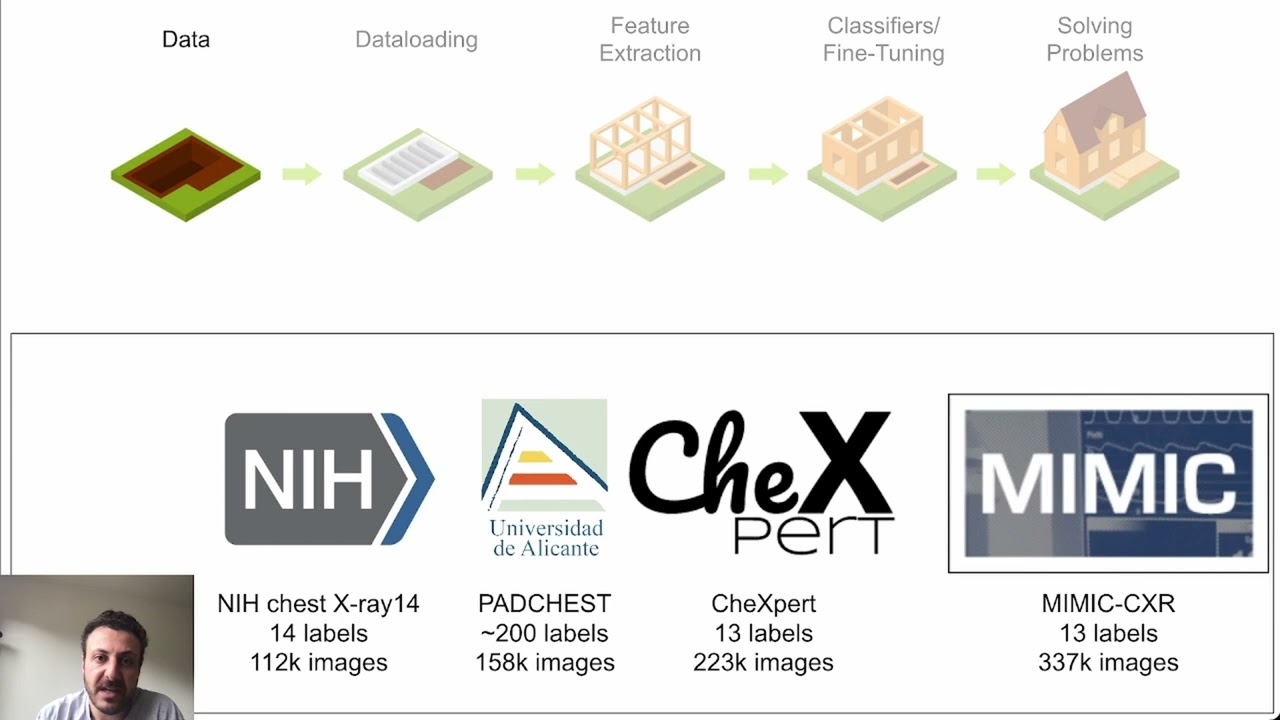 TorchXRayVision: A library of chest X-ray datasets and models