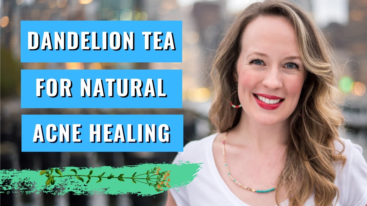 Dandelion tea for acne clearing - MY SECRET ACNE CLEARING WEAPON