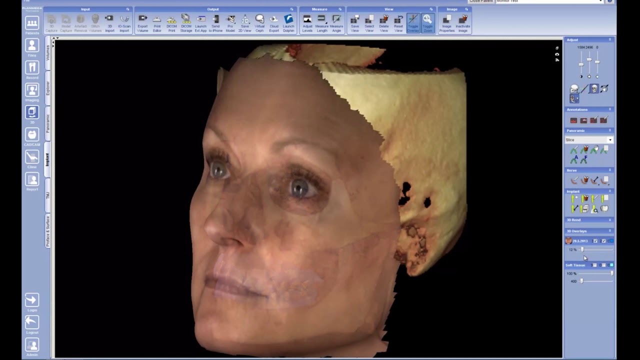 Planmeca ProMax 3D Classic