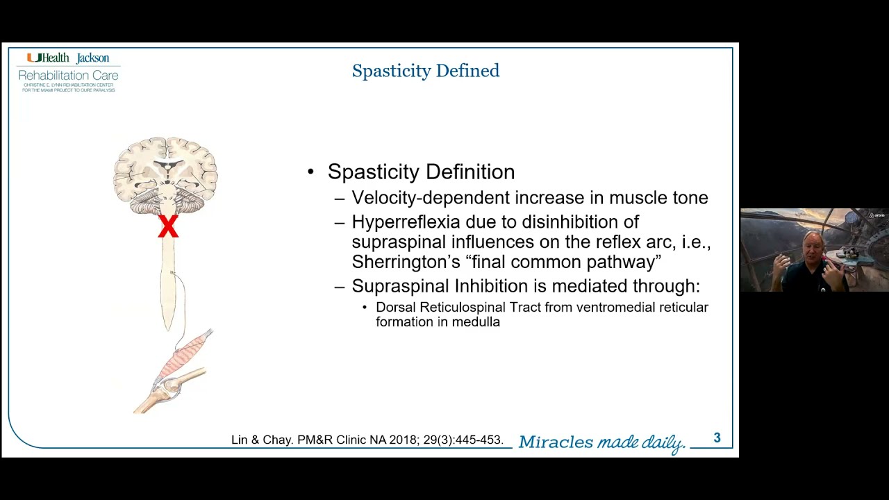 Spasticity after Spinal Cord Injury