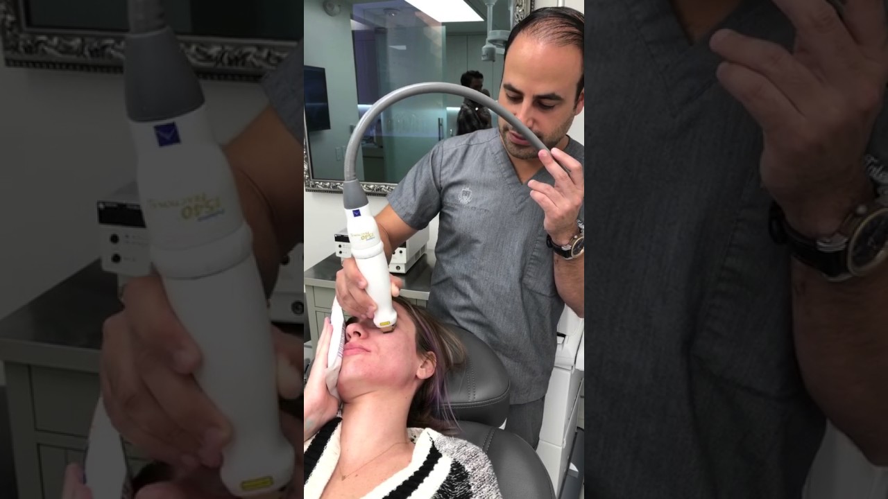 1540 skin resurfacing laser no downtime for acne, pores, pigment, stretch marks CO2 fraxel like