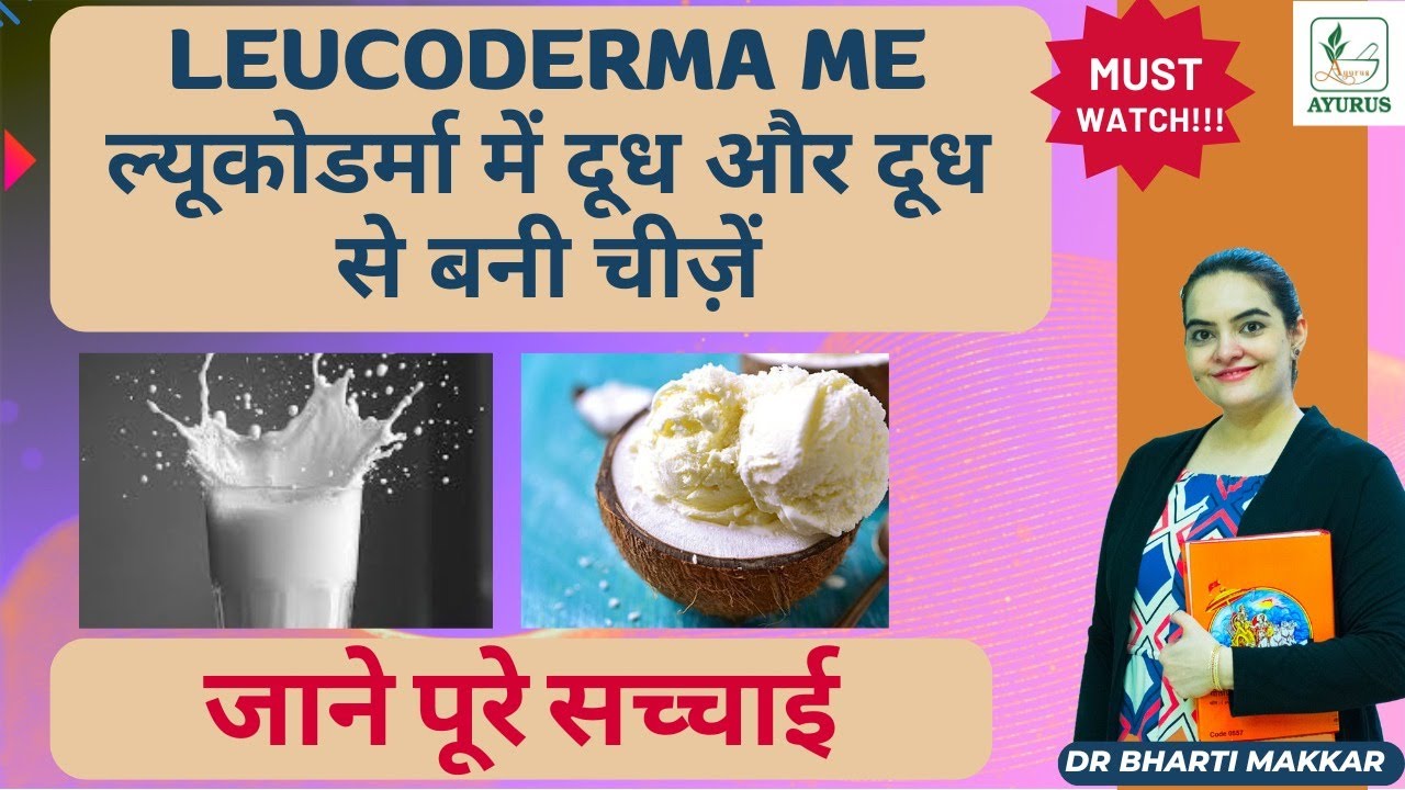 Milk and milk products in Leucoderma Yes or No | Dr. Bharti Makkar