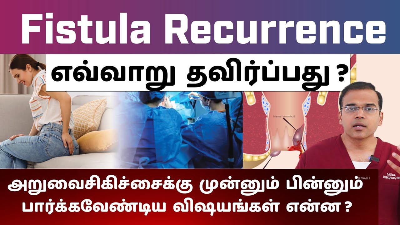 How to avoid Fistula Recurrence in tamil | Precautions to be Taken Before and After Fistula Surgery
