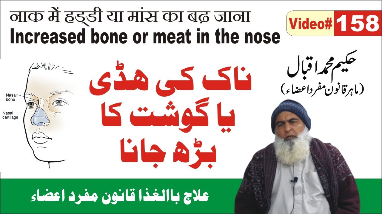 Increased Bone Or Meat In The Nose ►#158 ► ناک میں ہڈی کا بڑھنا ►नाक में हड्डी या मांस का बढ़ जाना