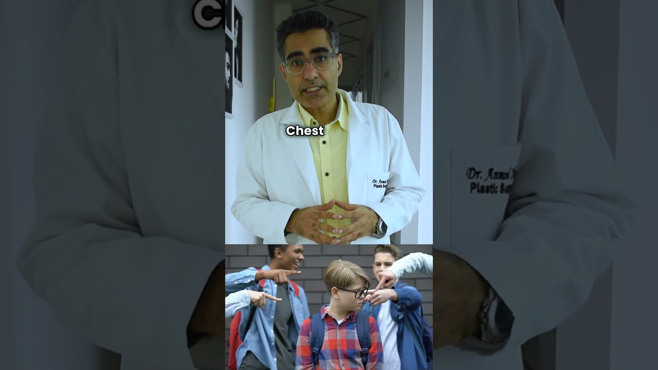 Story of 16-year-old Gynecomastia Patient |  #gynecomastia