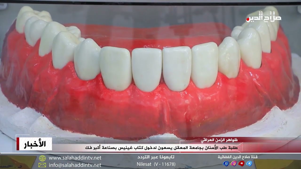 طلبة طب الأسنان بجامعة المعقل يسعون لدخول كتاب غينيس بصناعة أكبر فك