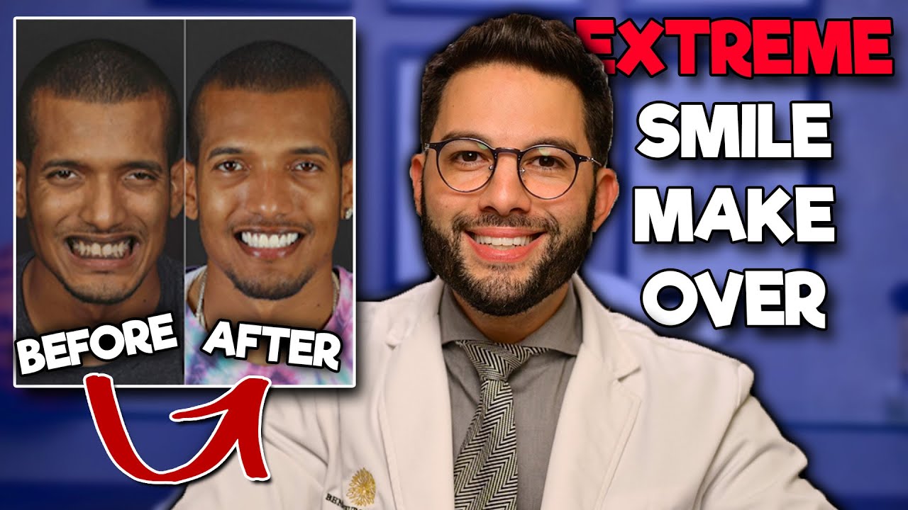 Extreme Smile Makeover | Dr Daniel DDS