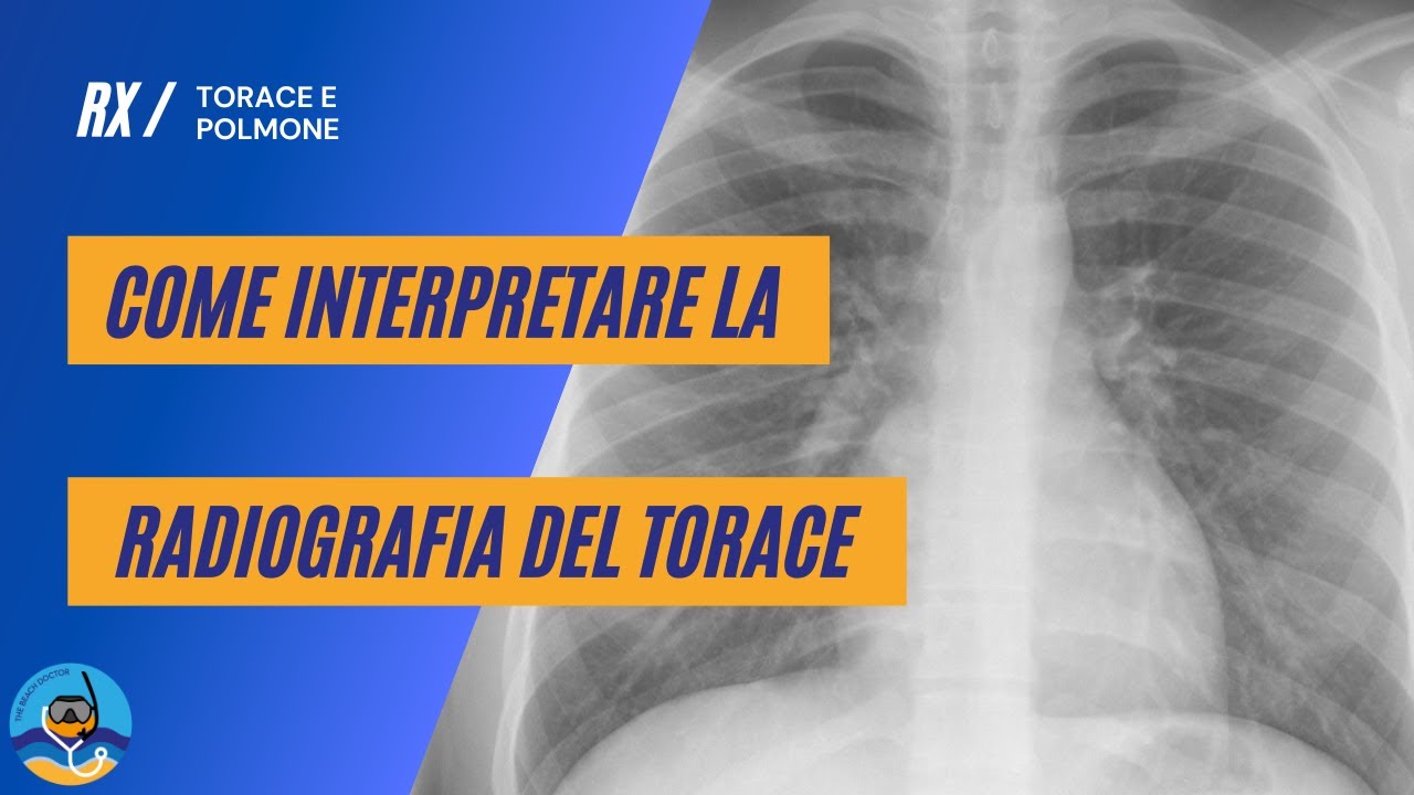 Come interpretare la radiografia del torace