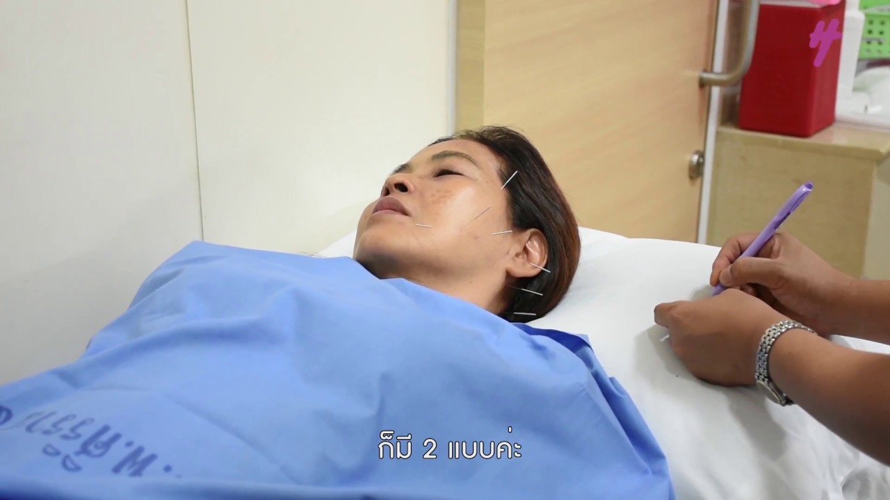 Healthy secret ตอนฝังเข็มคืออะไร