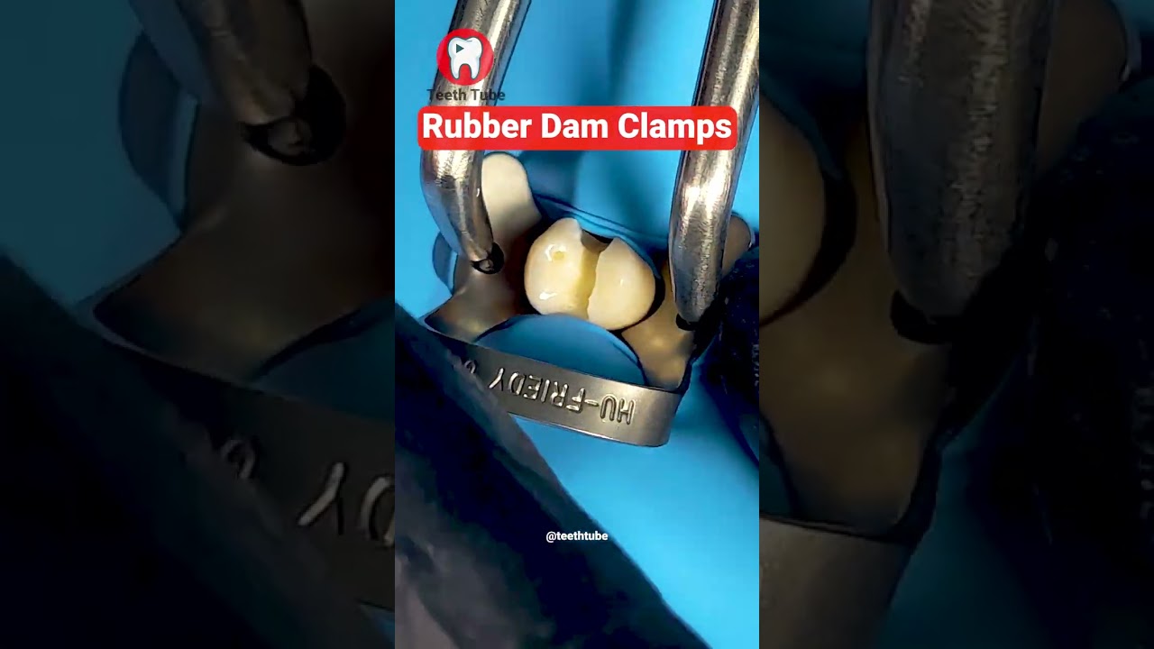 Rubber Dam Clamps #shorts