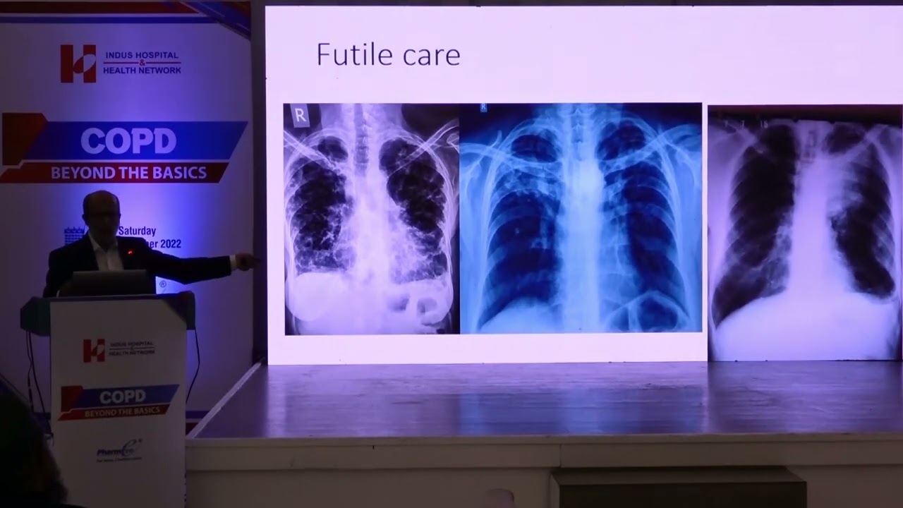 CME - COPD: Beyond Basics | November 26, 2022 | Dr. Sohail Akhter