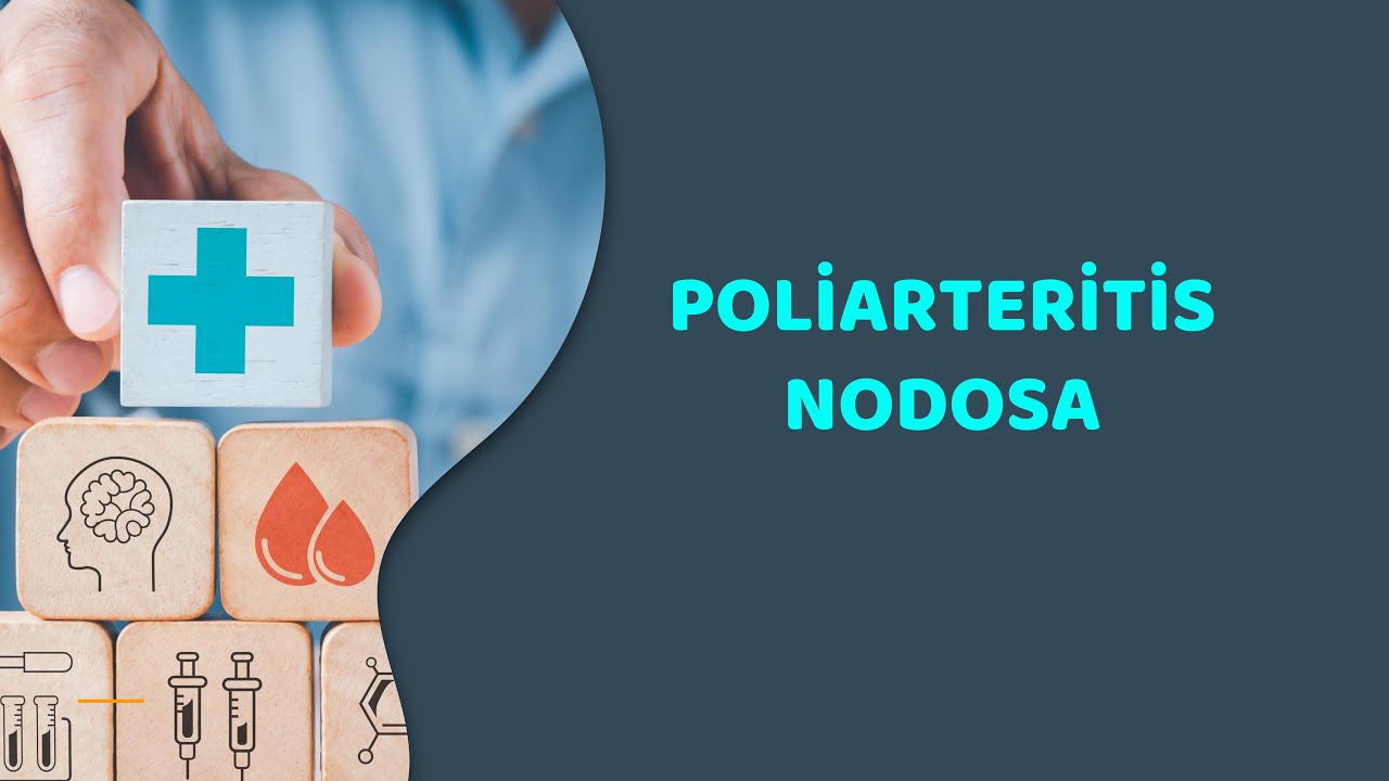 Poliarteritis nodosa sorusu (VAKA KAMPI ÖRNEK SORU ÇÖZÜMÜ)