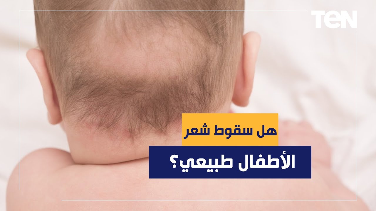 هل سقوط شعر الأطفال طبيعي؟ الدكتور هاني الناظر يجيب