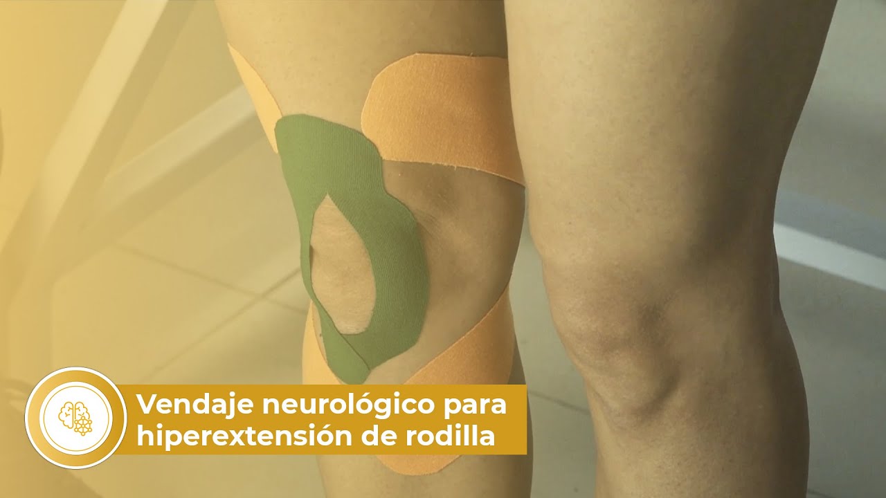 Vendaje Neurológico: Aplicación en Hiperextensión de Rodilla