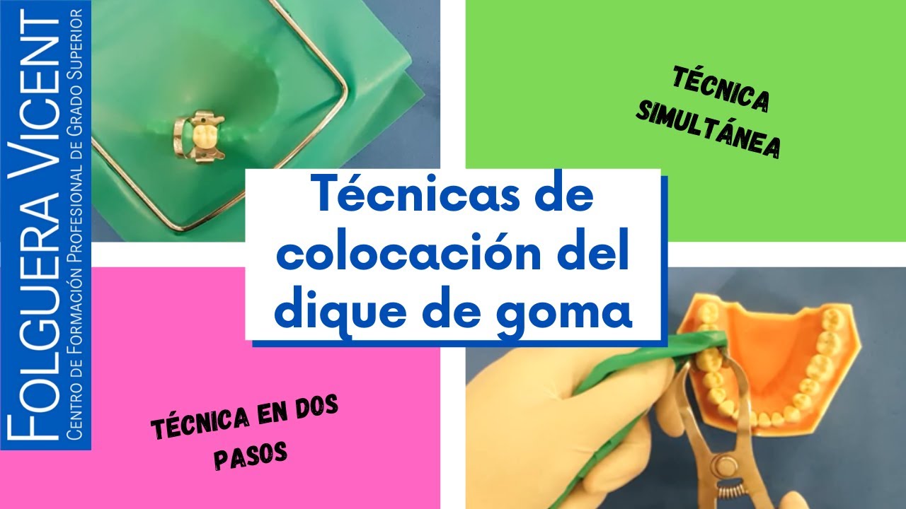 Técnicas de colocación del dique de goma: técnica en dos pasos y técnica simultánea