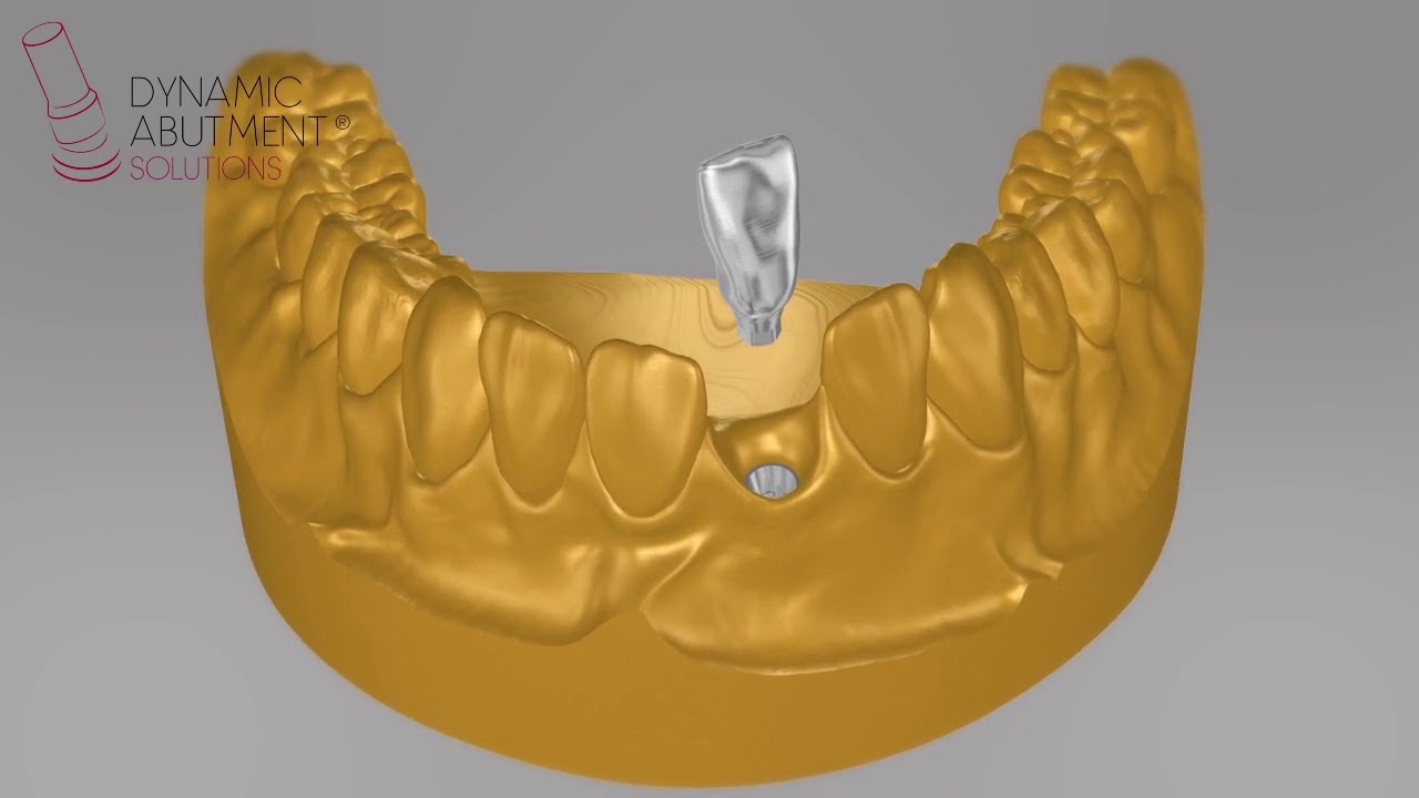 DIGITAL ANALOG INTRAORAL
