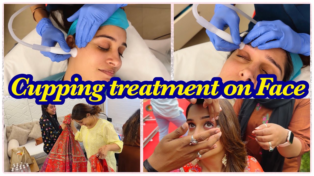 Tried Cupping Treatment on Face| Face Tightening | Shoot Ki taiyaari| Masti On the Set