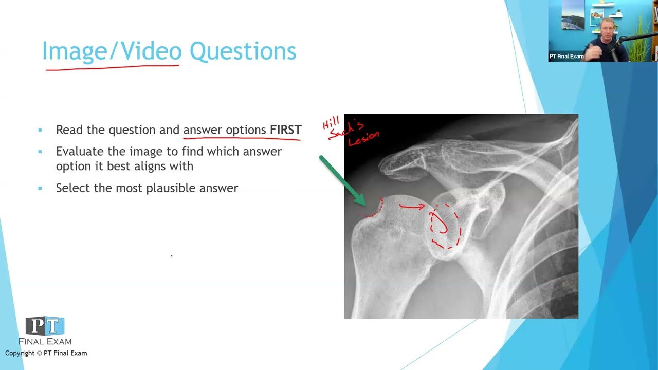 NPTE Multiple-Choice Question Strategies | How to Answer Questions