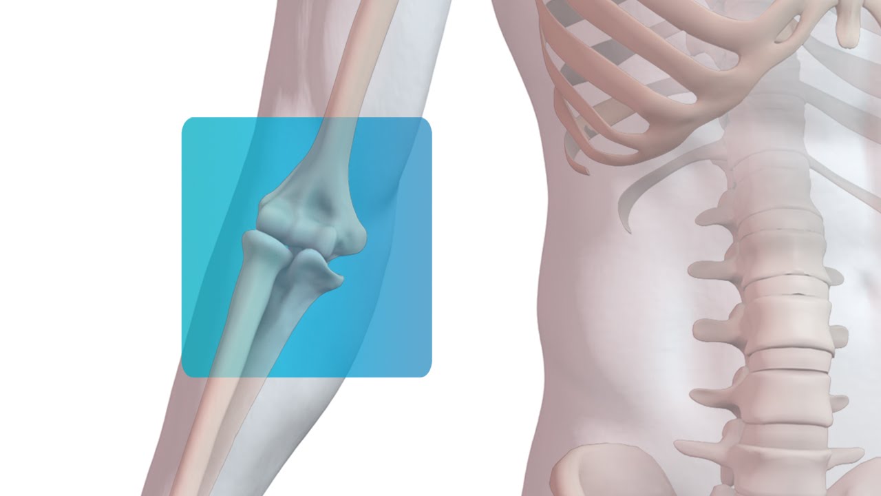 Distal Biceps Repair with Arthrex&reg; Tension Slide