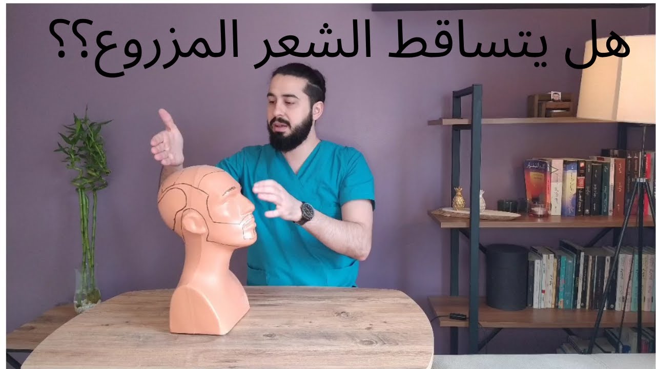 هل يبقى الشعر المزروع مدى الحياة؟