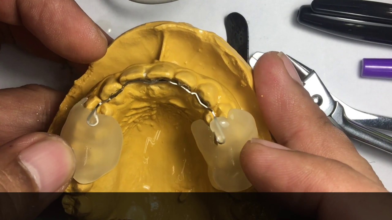 DIY FIXED LINGUAL RETAINER