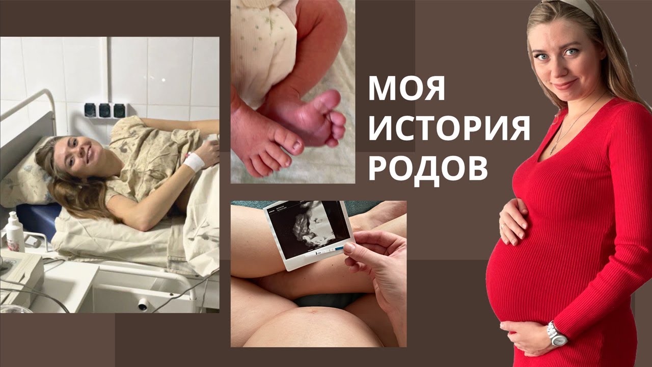 МОИ РОДЫ / КАК ЭТО БЫЛО / 16 ЧАСОВ РОДОВ