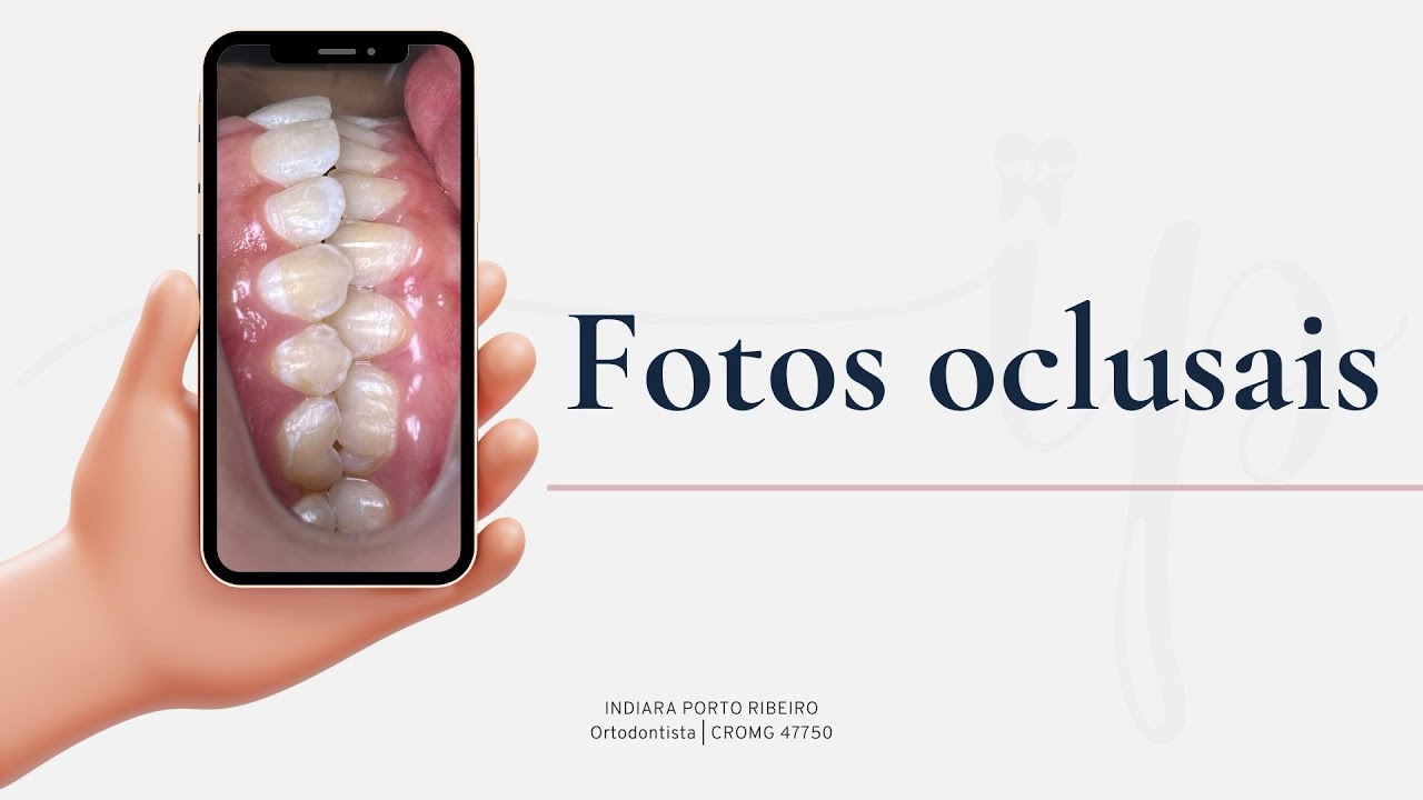 Fotos oclusais com celular