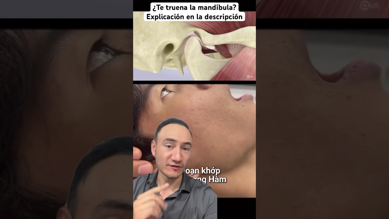 Así se ve como truena la mandíbula. 😮