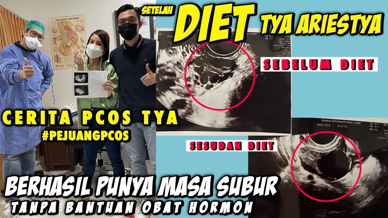 DIET... TYA ARIESTYA BERHASIL PUNYA MASA SUBUR TANPA BANTUAN OBAT HORMON