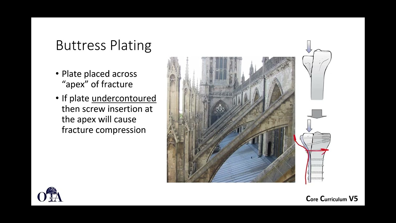 Basic principles of internal fixation - 2 of 2