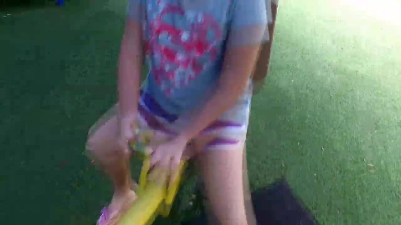 Playground equipment leading to serious injuries, research shows