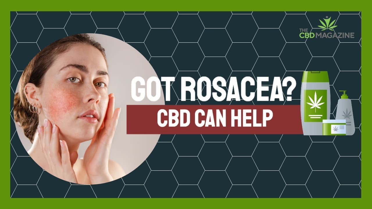 Research about CBD and dry skin | The best CBD cream for rosacea