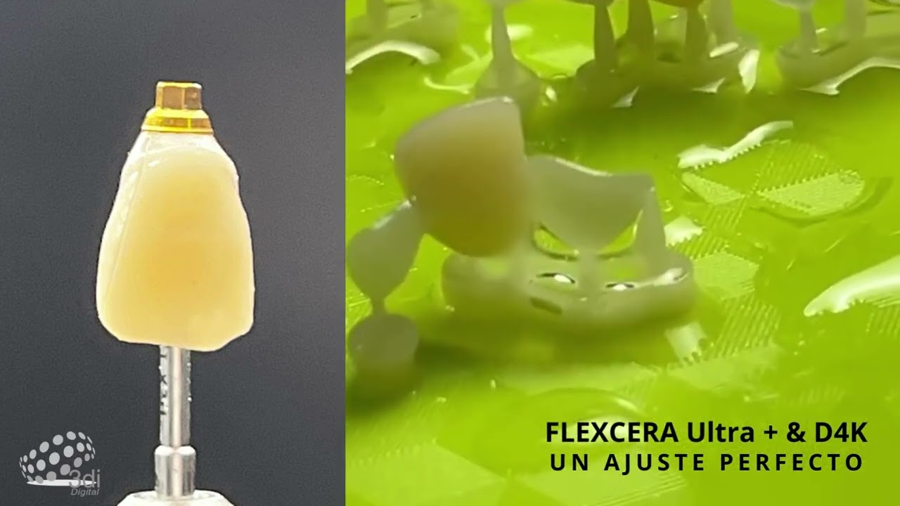 FLEXCERA Ultra + & D4K