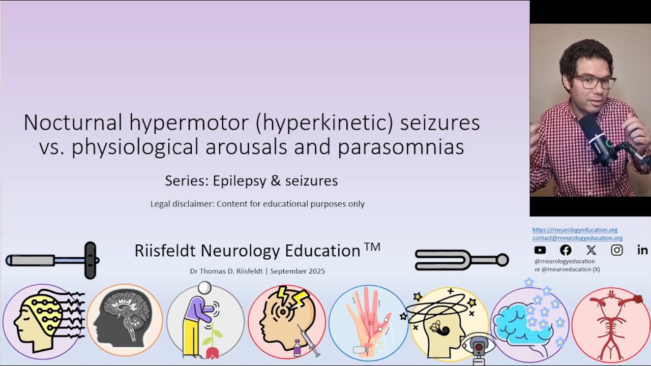 Nocturnal hypermotor (hyperkinetic) seizures vs. physiological arousals & parasomnias