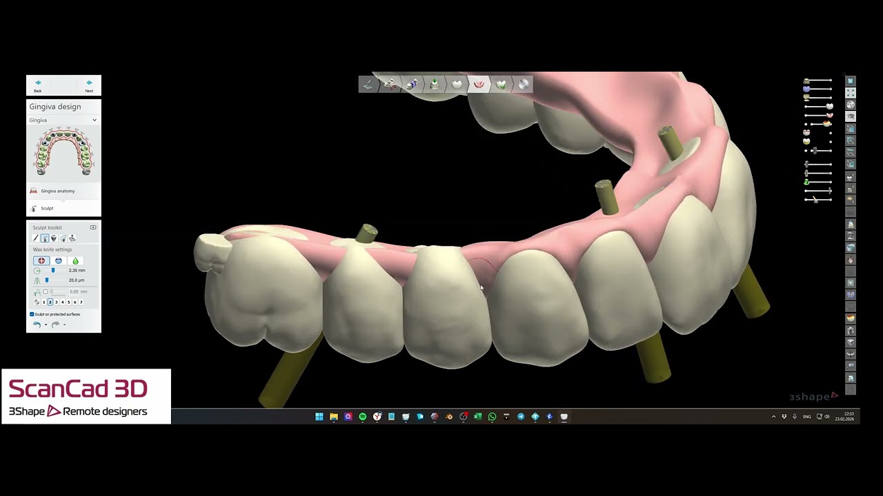 3shape 02-22-2026 L