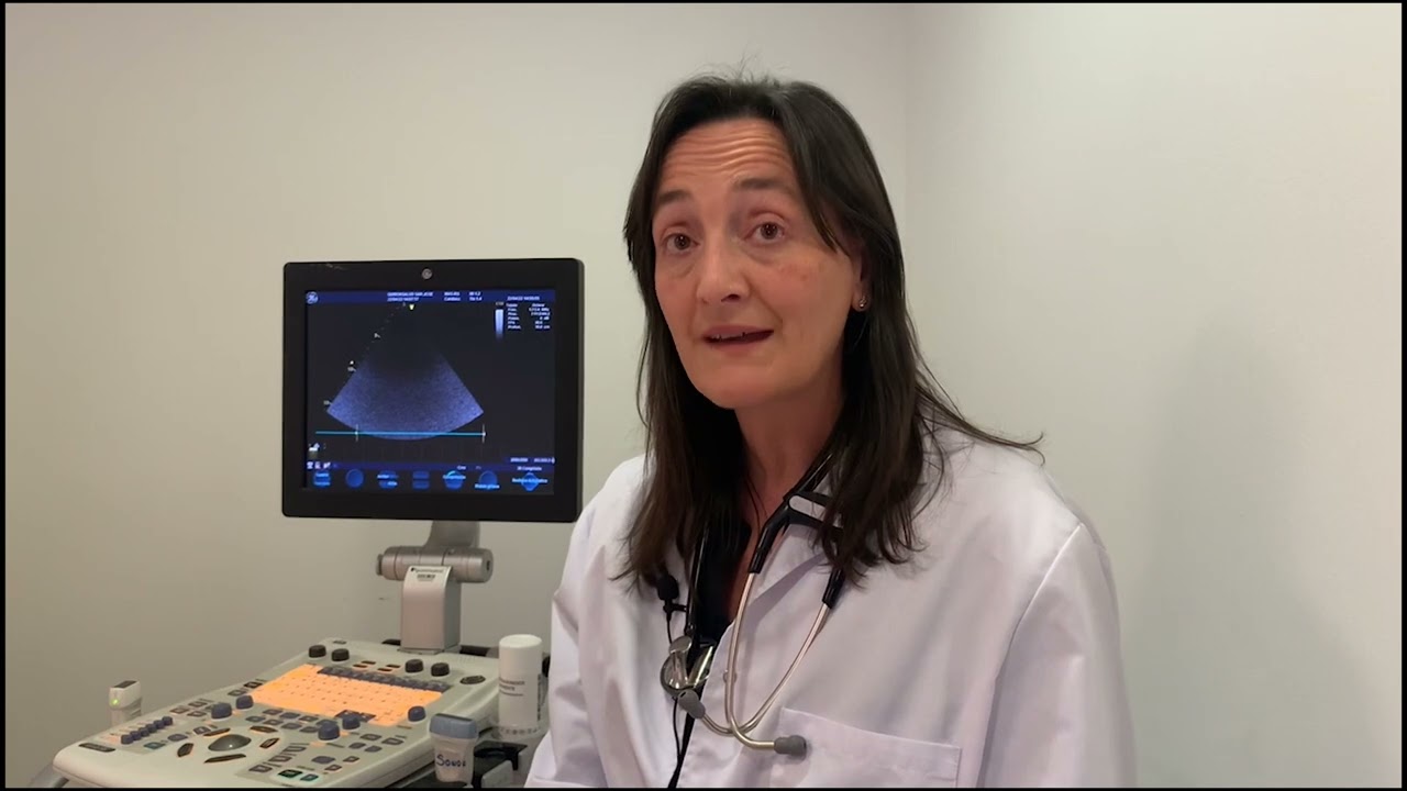 Secuelas cardiológicas del COVID-19 y COVID persistente