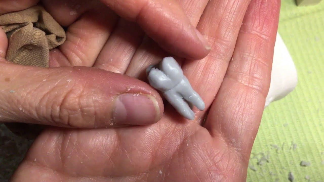 Tallado Primer molar superior permanente