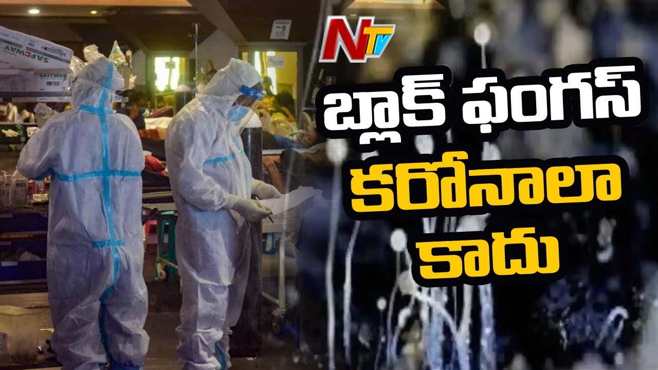 ENT Specialist Dr. Ravi Shankar Face to Face Over Black Fungus Disease and Symptoms l Ntv