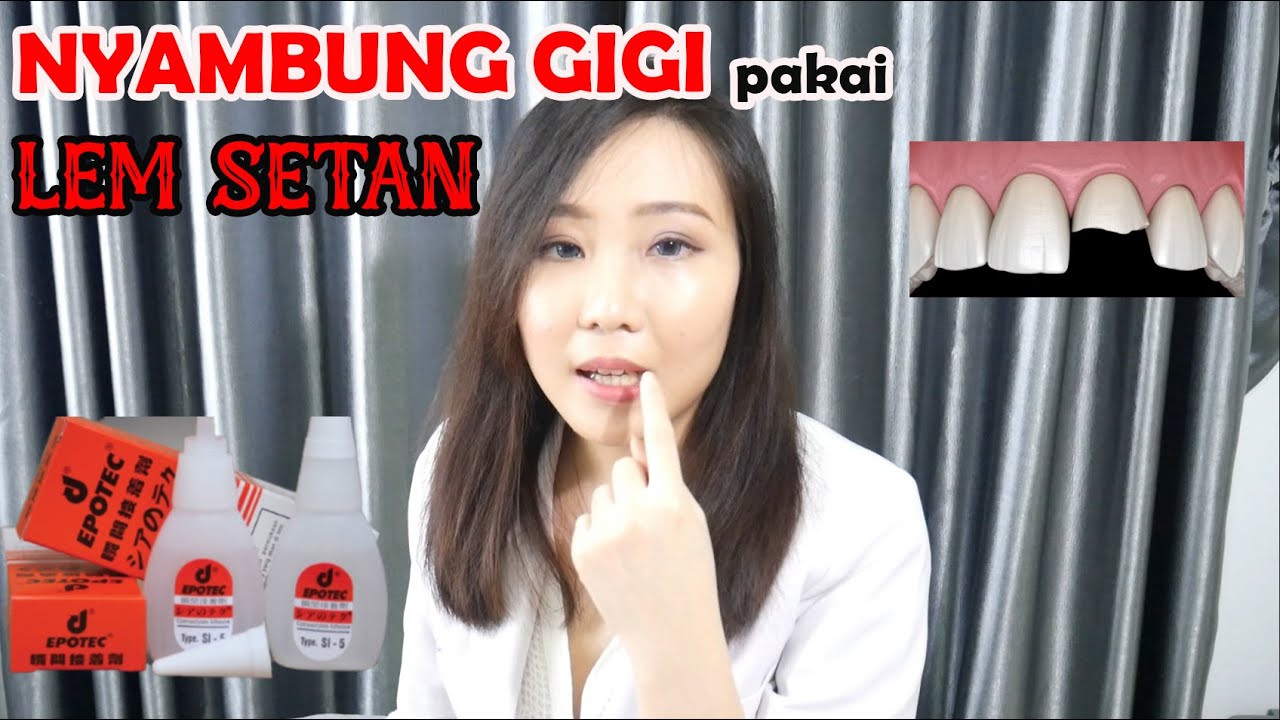 Gigi Patah BISA Disambung Pakai Lem Setan, Pernah Coba?