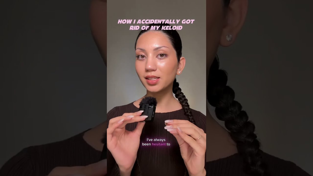 How i accidentally got rid of my keloid (piercing scar)