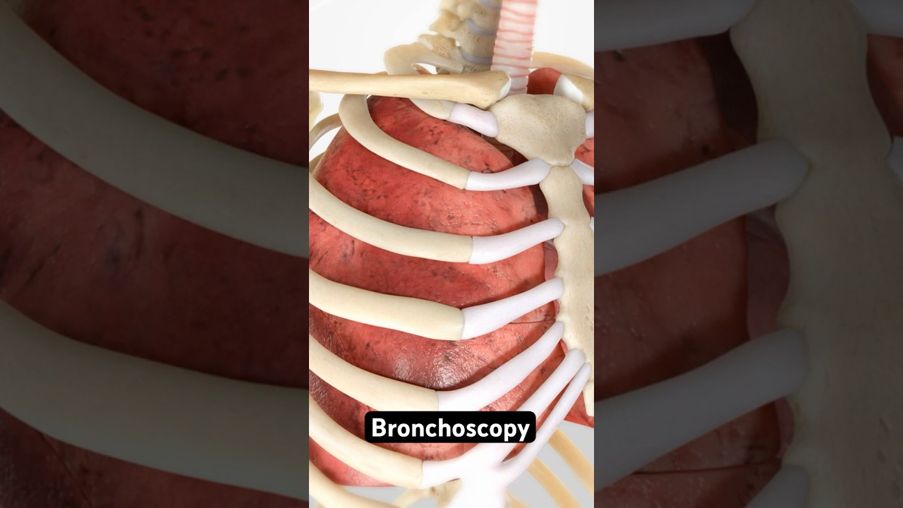 What is Bronchoscopy? (3D Animation)