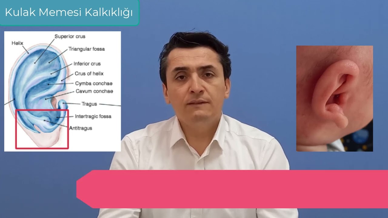 Bebeklerde Kulak Memesi Kalkıklığı Nasıl D&uuml;zeltilir?