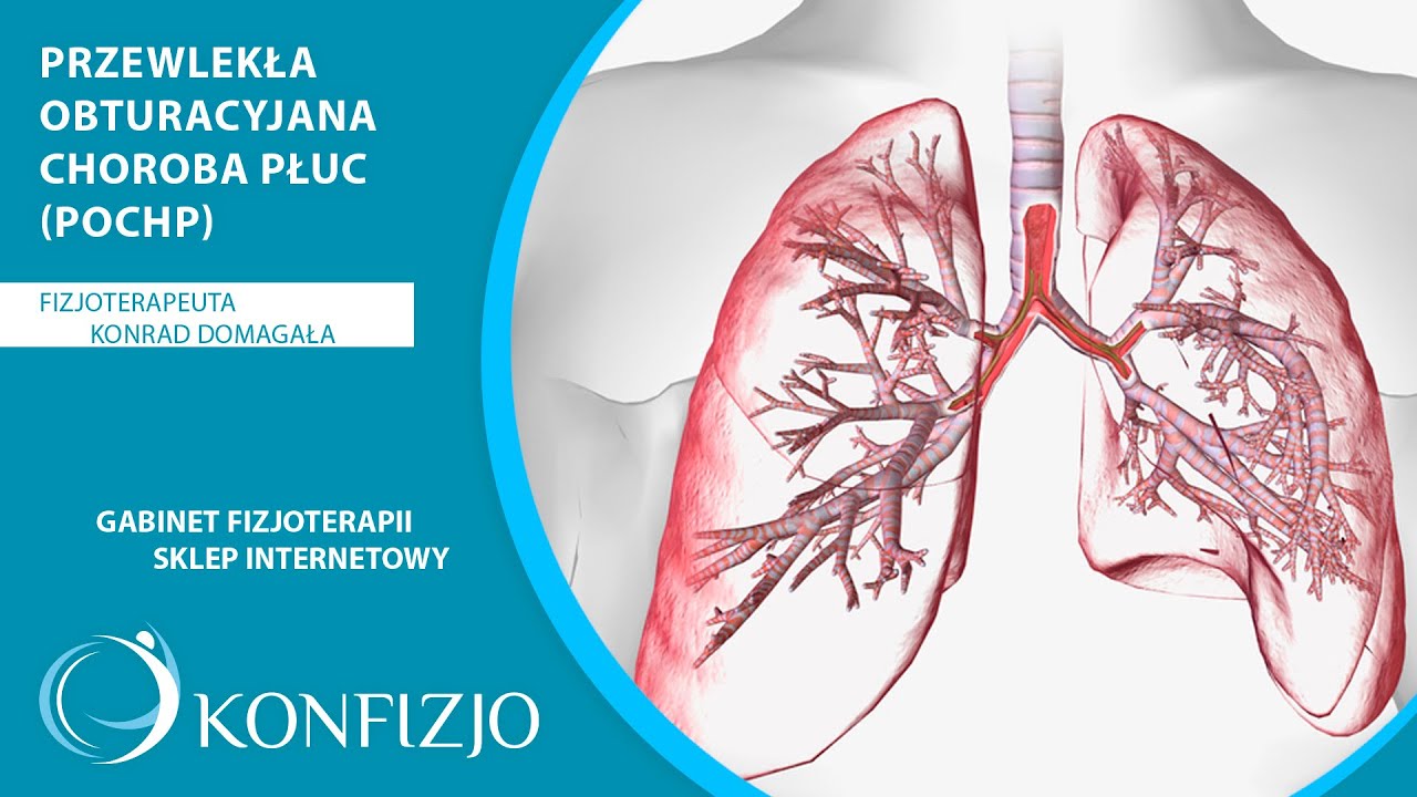 Przewlekła obturacyjna choroba płuc (POChP), objawy, przyczyny, diagnostyka, leczenie, rehabilitacja